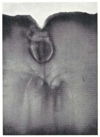 Silver Nitrate - Easter 1927